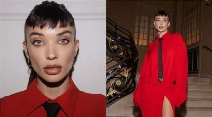 Emily Jackson Plastic Surgery: Before And After Photos