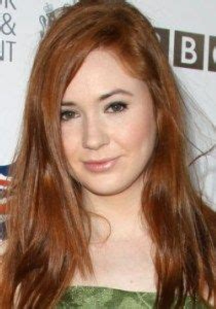 Karen Gillan Plastic Surgery Before and After
